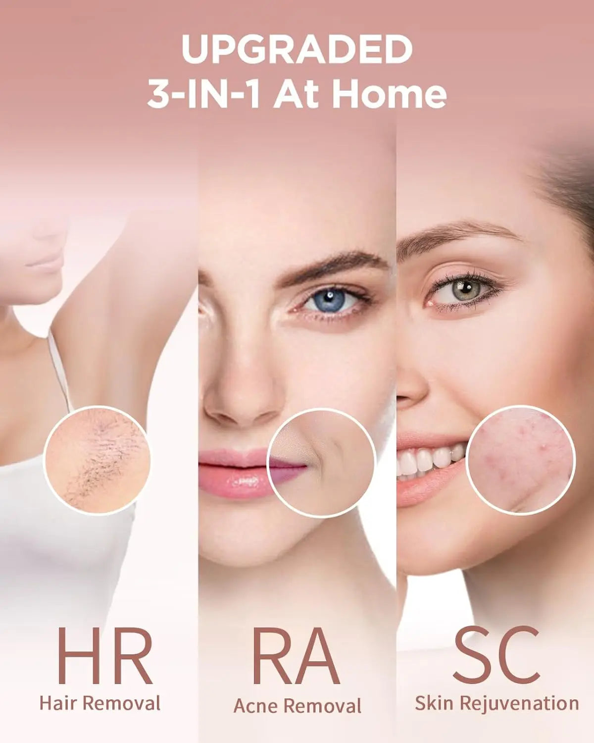 Gentle soft Laser Hair Removal Device for All Body Areas
