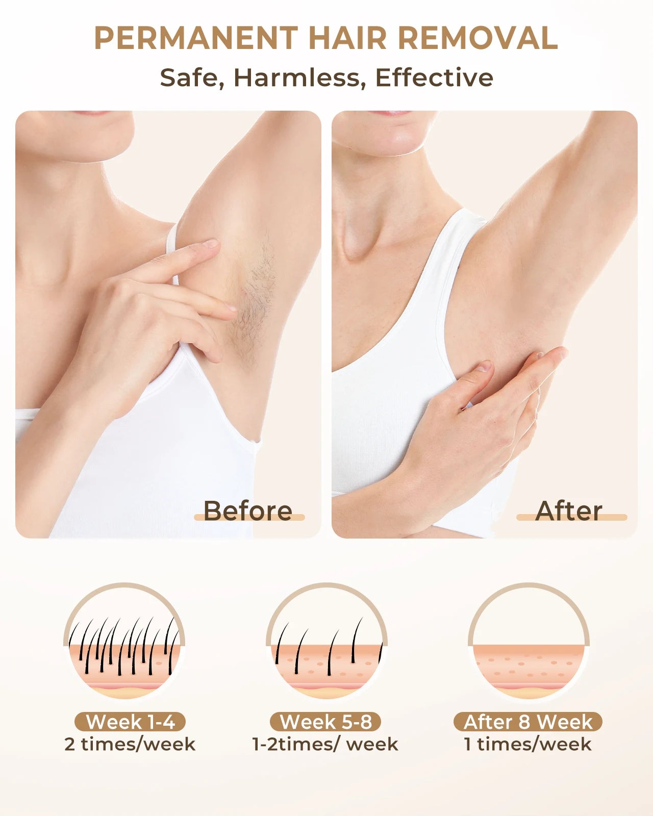 Gentle soft Laser Hair Removal Device for All Body Areas
